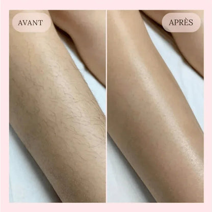 NuitLisse™ Épilation sans douleur pour une peau parfaitement lisse