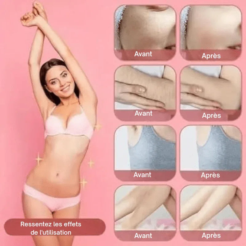 NuitLisse™ Épilation sans douleur pour une peau parfaitement lisse