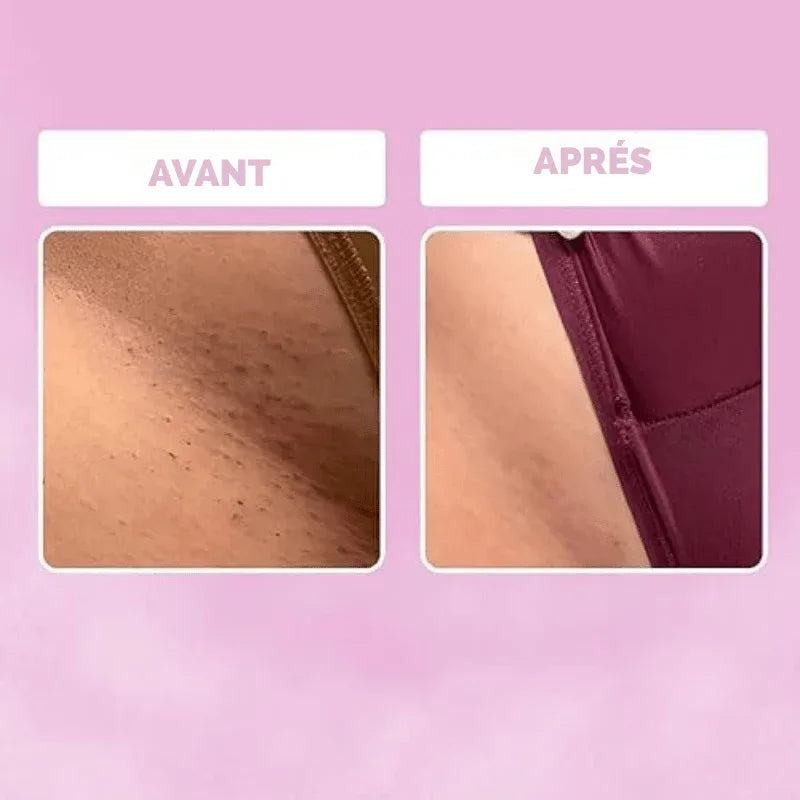 NuitLisse™ Épilation sans douleur pour une peau parfaitement lisse