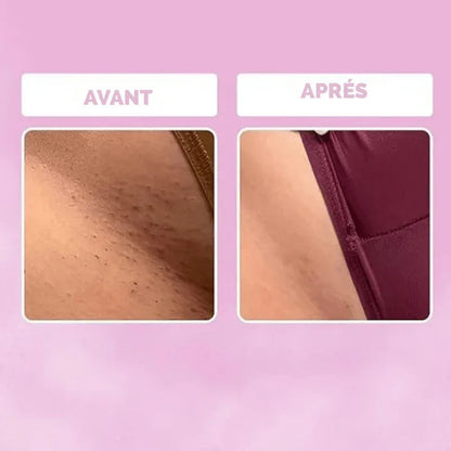NuitLisse™ Épilation sans douleur pour une peau parfaitement lisse